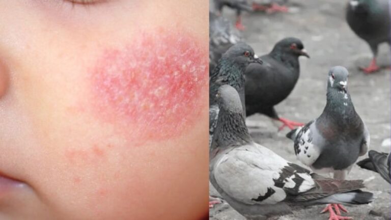 moradores-de-lucas-do-rio-verde-relatam-dermatite-apos-visita-a-espacos-publicos